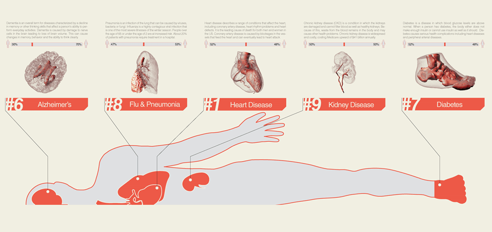 3d-printing-in-healthcare-2 3d-printing-in-healthcare-2